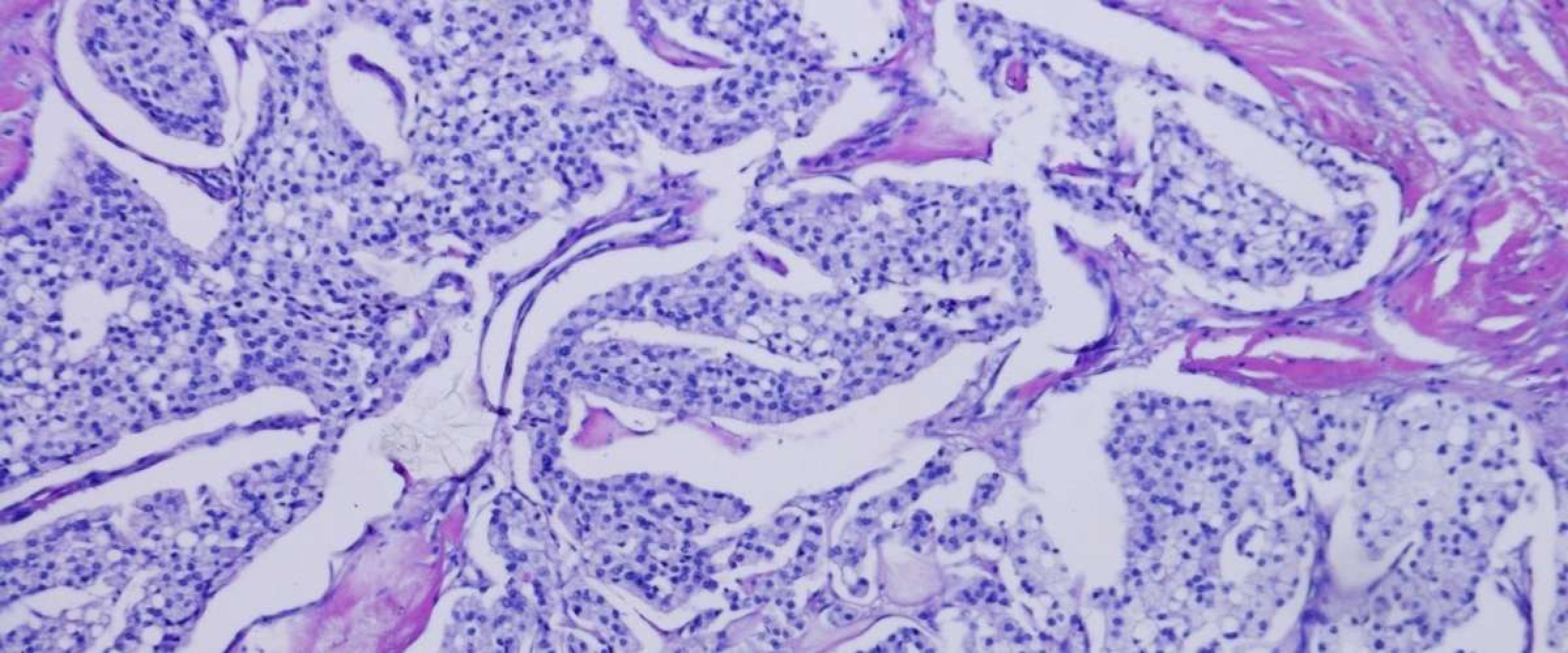 A patient's guide to Neuroendocrine Tumours (NET) by Medical Oncologist ...